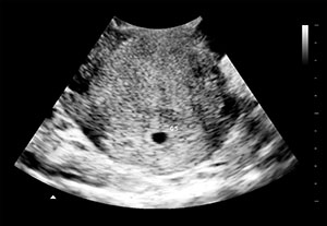 假怀孕4周b超图
